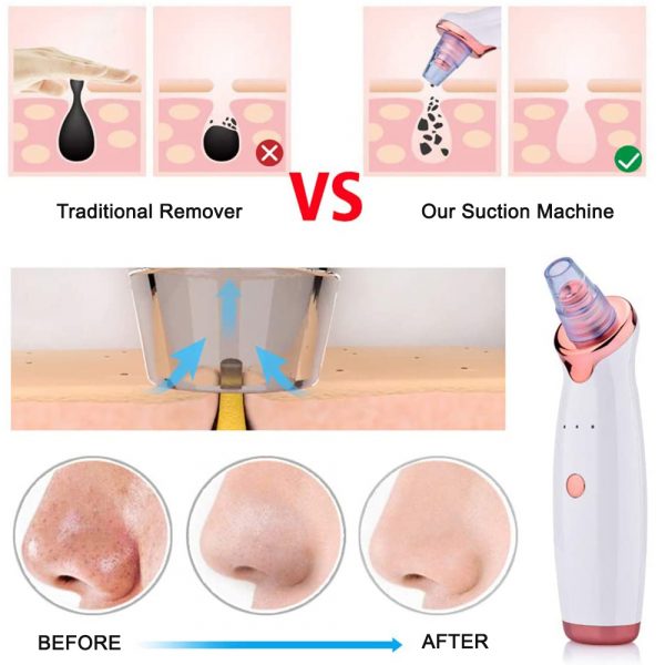 5 Nozzle Facial Blackhead Remover Electric Pore Cleaner Electric Suction Pore Cleaner_4