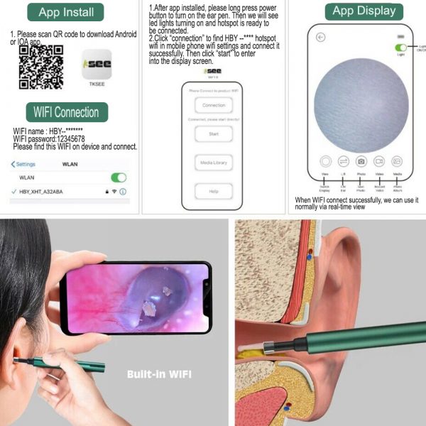 WI-FI Enabled HD Wireless Otoscope Earwax Remover Visual Ear Cleaner_7