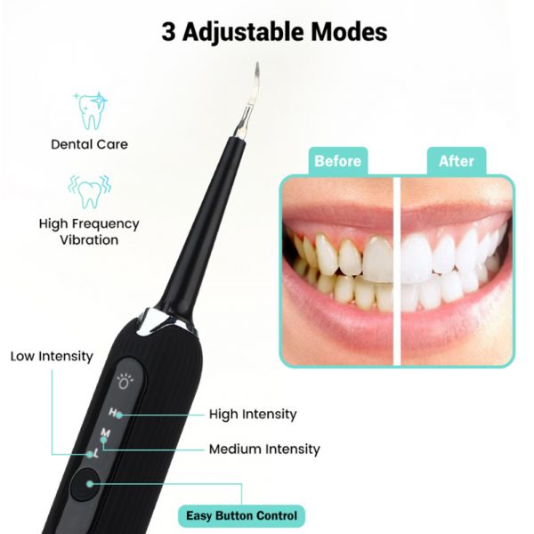 Rechargeable Electric Tooth Plaque Cleaning Kit with LED Light_8